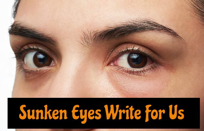 Sunken Eyes Write For Us